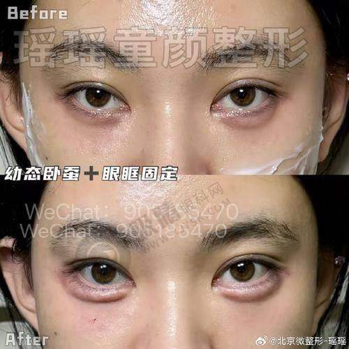 恩施美年华整形医院