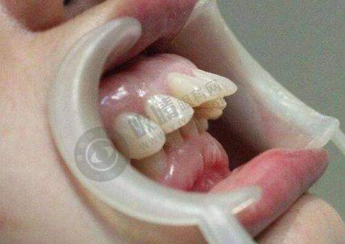 总结