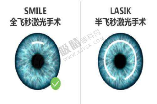 韩国healing眼科特色项目及技术优势
