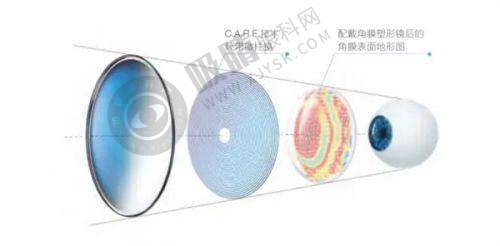 [Noble眼科医院]预约挂号方式及流程