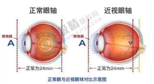 [湖南识目睛点眼科医院]患者评价