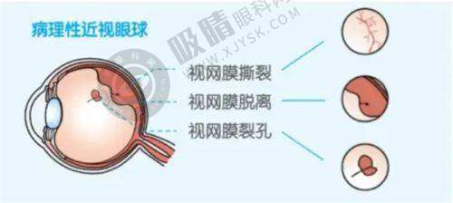 [徐州复兴眼科医院]简介概述