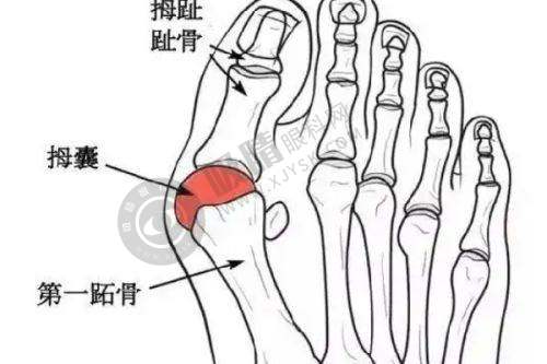 袁强博士拉皮手术的成效与患者满意度