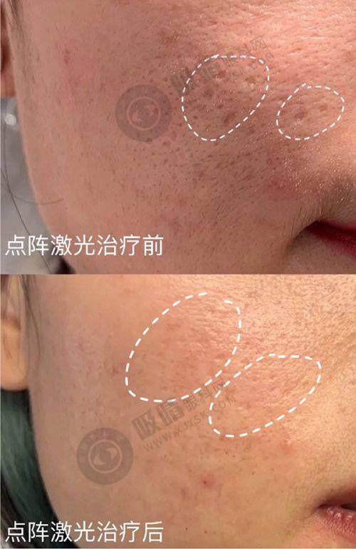 南宁华美整形2025价目表曝光！隆鼻8100起+医生团队实力解析