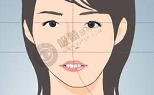 李健钢面部提升实例展示