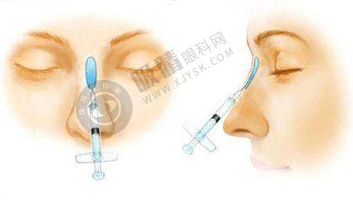 谢宏彬医生怎么预约？挂号方式+出诊时间+擅长拉皮价格全解析！