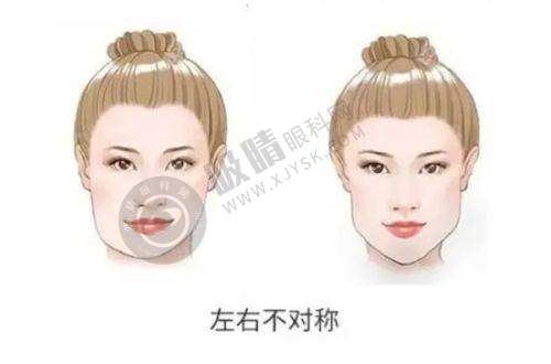 沈阳整形医院哪家强？前十排名公布+价格表曝光，光子嫩肤案例分享