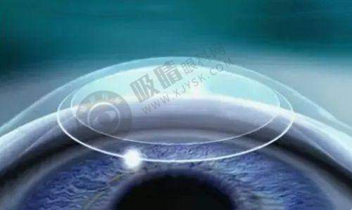 三、保定德仁眼科医院的技术和设备怎么样？
