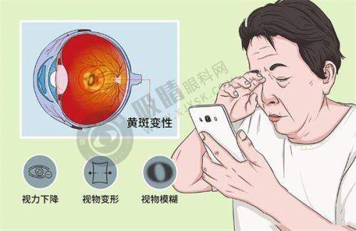 柳州赋盈眼科医院全飞秒手术效果如何？术后视力恢复快，德国蔡司设备+个性化方案更靠谱