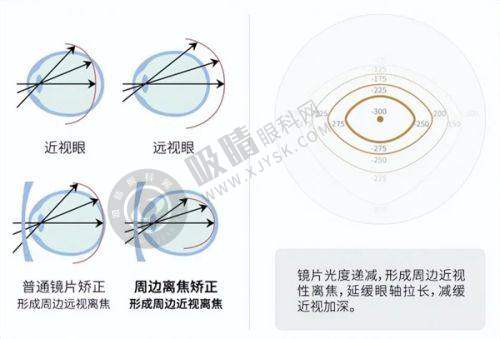 五、如何前往韩国江南好眼睛眼科医院?