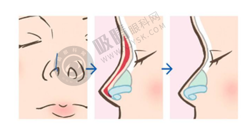 袁强博士的坐诊医院介绍