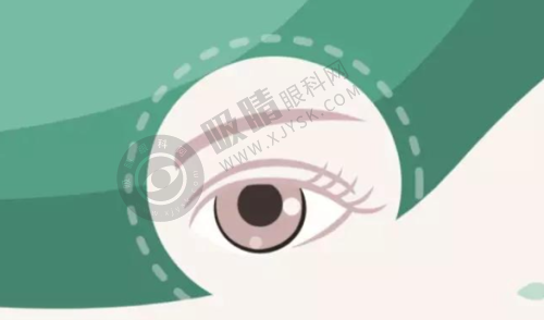 二、新疆乌鲁木齐美尼康眼科医院全飞秒手术的优势有哪些？