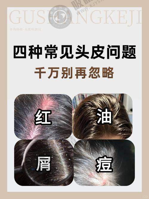北京碧莲盛植发怎么样：医院特色亮点