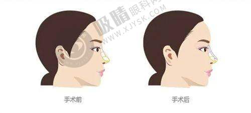 2025恩施整形医院哪家强？天后VS美年华真实测评+价格大公开！