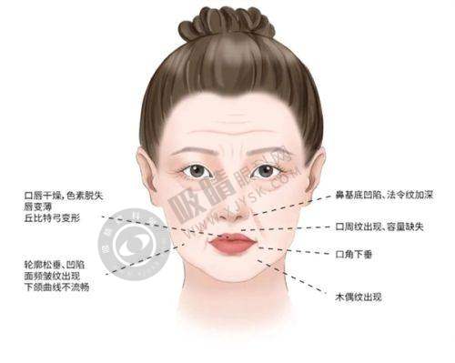 黑龙江哈尔滨瑞丽整形医院怎么样？A级资质+爱贝芙注射指定机构，内窥镜隆胸技术口碑好