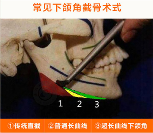 总结