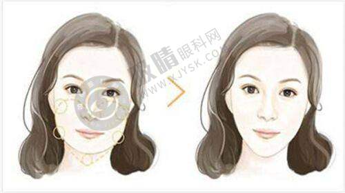 揭秘!乔雅登美神针能否刺激胶原再生?大陆审批进度+持久塑颜效果解析