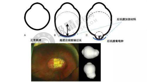 眼科专家任春慧：40年经验如何攻克白内障、青光眼等疑难眼病？