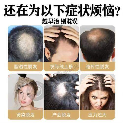 南京建国领秀植发怎么样？27年老牌医院靠谱，FUE无痕植发3.8元/单位，真人案例效果自然