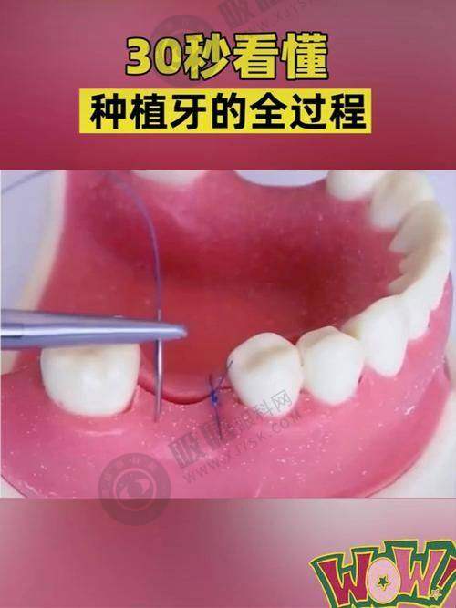 襄阳海峡明朗口腔门诊部患者评价