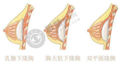 人员资质：沈阳京科私密整形医院专精团队，为私密整形保驾护航