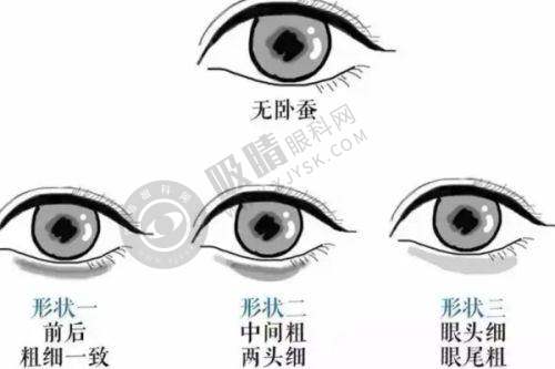 昆山玥美医疗美容是正规的吗？资质齐全设备先进，专业医生团队打造自然美