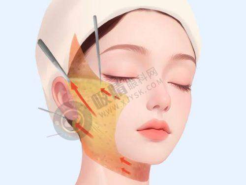 揭秘杭州瑞丽医美正规资质，国际设备+专家团队打造个性化变美方案！