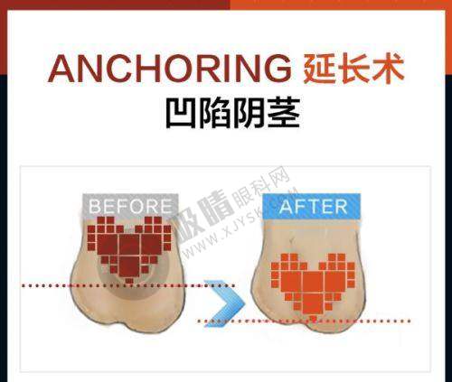 总结：北京嘉禾妇儿医院是北京私密整形的优质选择