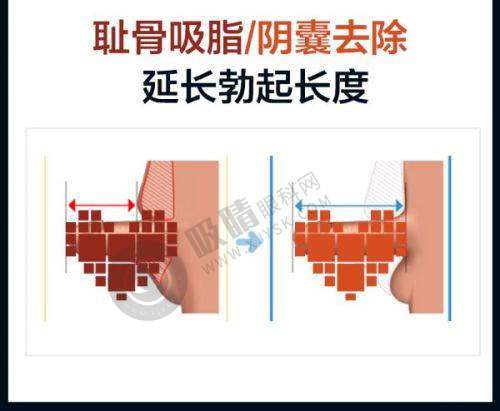 北京丽合医疗美容医院是几级医院？选择北京丽合的理由