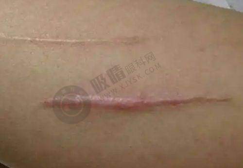 北京嘉禾妇儿医院私密整形医生介绍