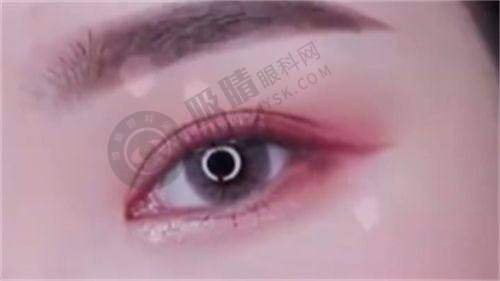 深圳非凡医疗美容医院是三等甲医院吗？总结与鼓励