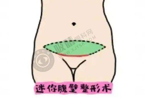 杭州天鑫整形医院正规吗？拱墅区审批正规医美机构，双眼皮/隆鼻满意度超高