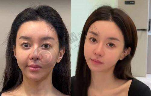 深圳美莱医疗美容医院——经验多的医美典范