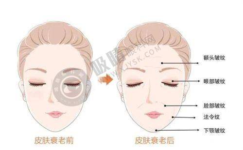 上饶韩美整形美容医院冰点脱毛怎么样：顾客口碑反馈良好