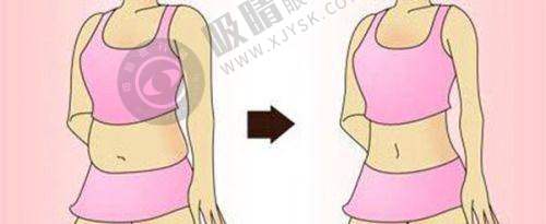 北京雅靓医疗美容——全方面7d聚拉提抗衰之选