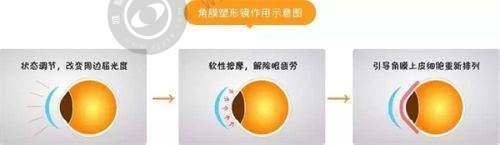 上海新视界眼科医院优惠及价格相关资讯