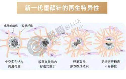 余姚艺美医疗美容门诊部超皮秒祛斑成效显著