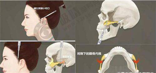 杭州浮想国医疗美容诊所其他医美项目怎么样？