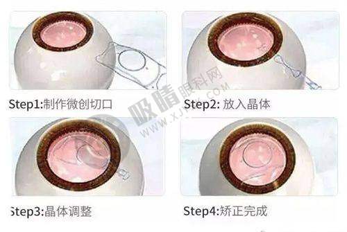 江阴市人民医院眼科医生名单及擅长项目(部分)