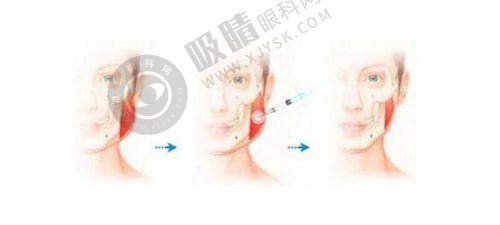 长春南关区久诺美医疗美容门诊部——正规资质的长春吸脂门诊部