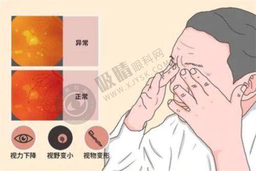 三、上海新视界眼科医院的技术和设备有哪些优势？