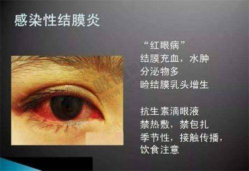 四、北京熙仁眼科医院的技术设备对医疗保险报销有影响吗?