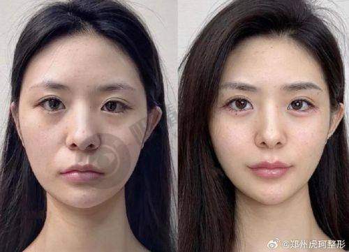 [宁波颜蕾医疗美容诊所]来院路线
