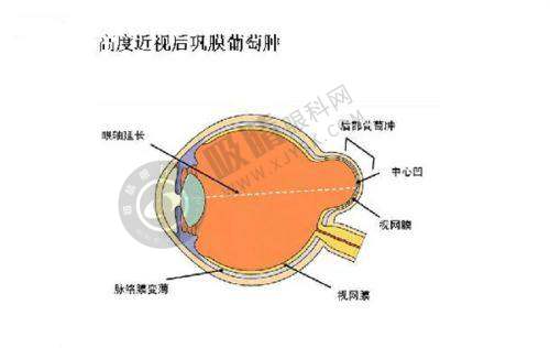 惠州惠城雷诺眼科门诊部优质服务与患者体验