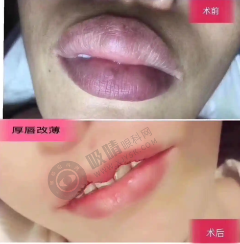 长沙县美颜树轻医美诊所周巧胜团队定制抗衰方案获星沙顾客好评