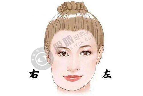 衡阳璐美仁医疗美容诊所隆鼻整形成效有保护吗？