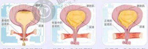关于杨蓉院长眼部整形的建议