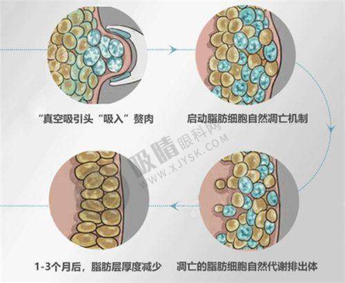 昆山星苑医疗美容门诊部——昆山较早开展整形美容的机构