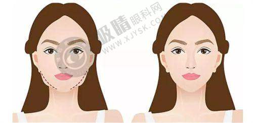选择衡阳璐美仁医疗美容诊所的理由是什么？