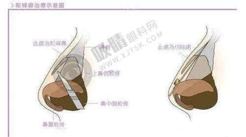 张家界逸韩整形美容医院：优质服务让你无忧变得更美